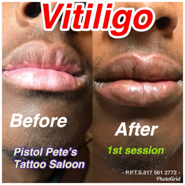 Permanent Lip Tattoo