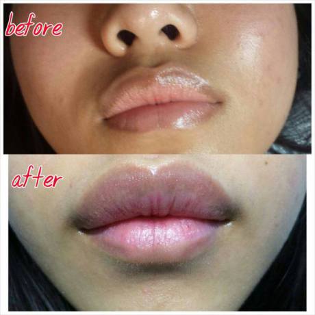Permanent Lip Tattoo